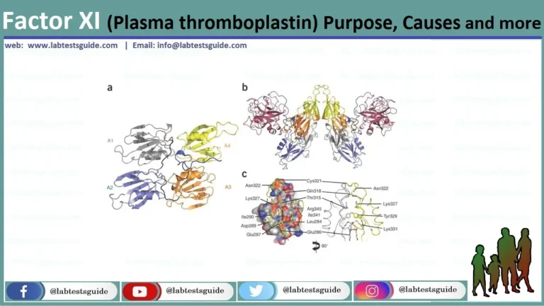 Factor XI (Plasma thromboplastin)