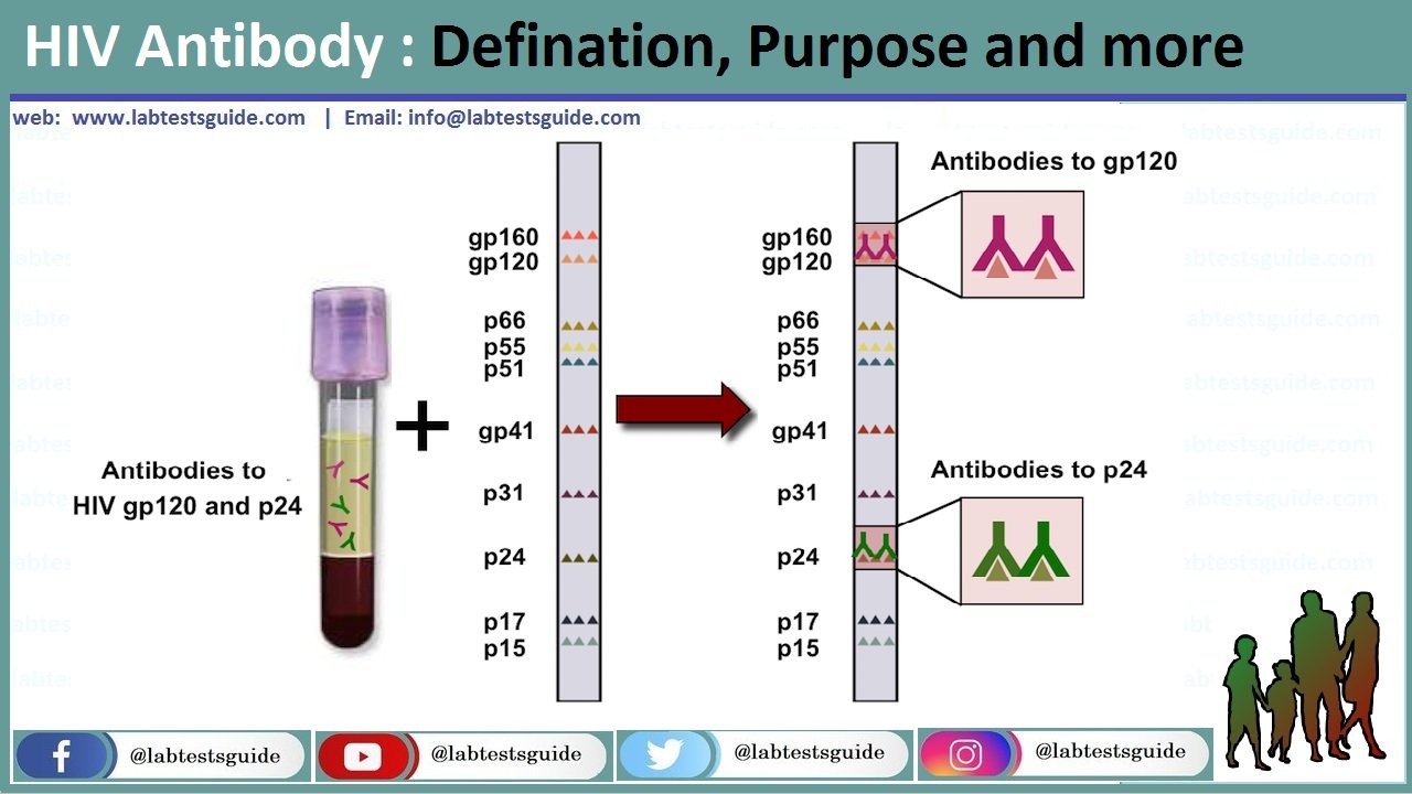 Hiv Antibody Defination Overview And More Lab Tests Guide 4285