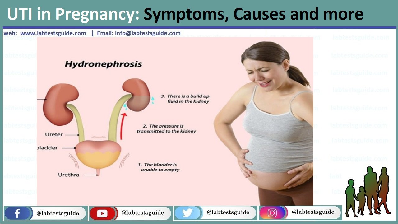 UTI In Pregnancy Symptoms Causes And More Lab Tests Guide