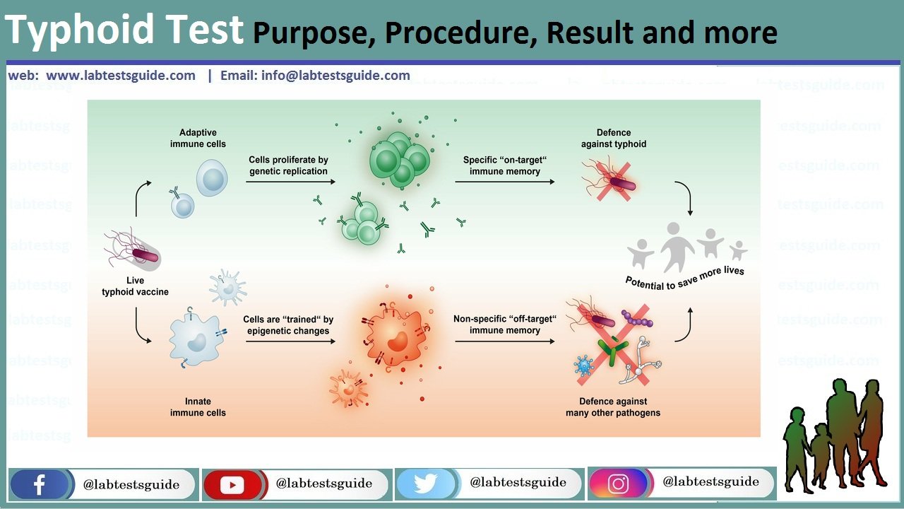 Typhidot Test Purposem Procedure, Result and more | Lab Tests Guide