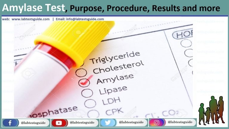 amylase-serum-test-purpose-procedure-result-and-more-lab-tests-guide