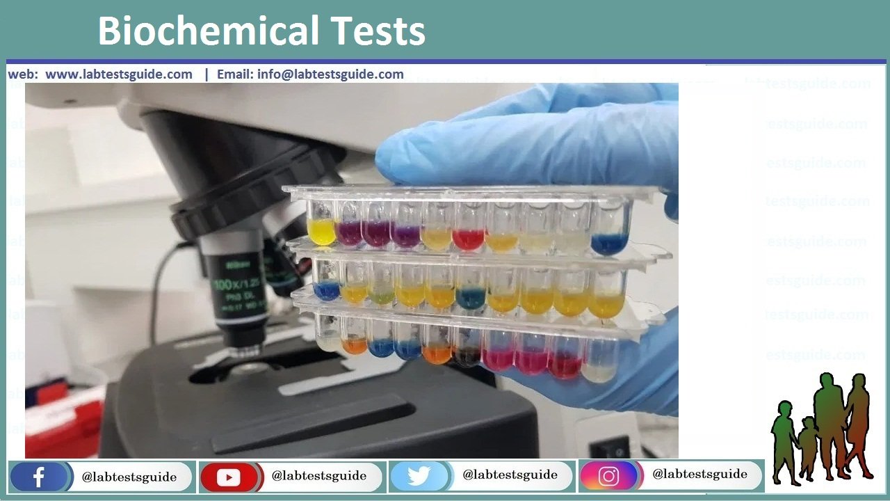 Staphylococcus Aureus Characteristics, Biochemical Tests And Others