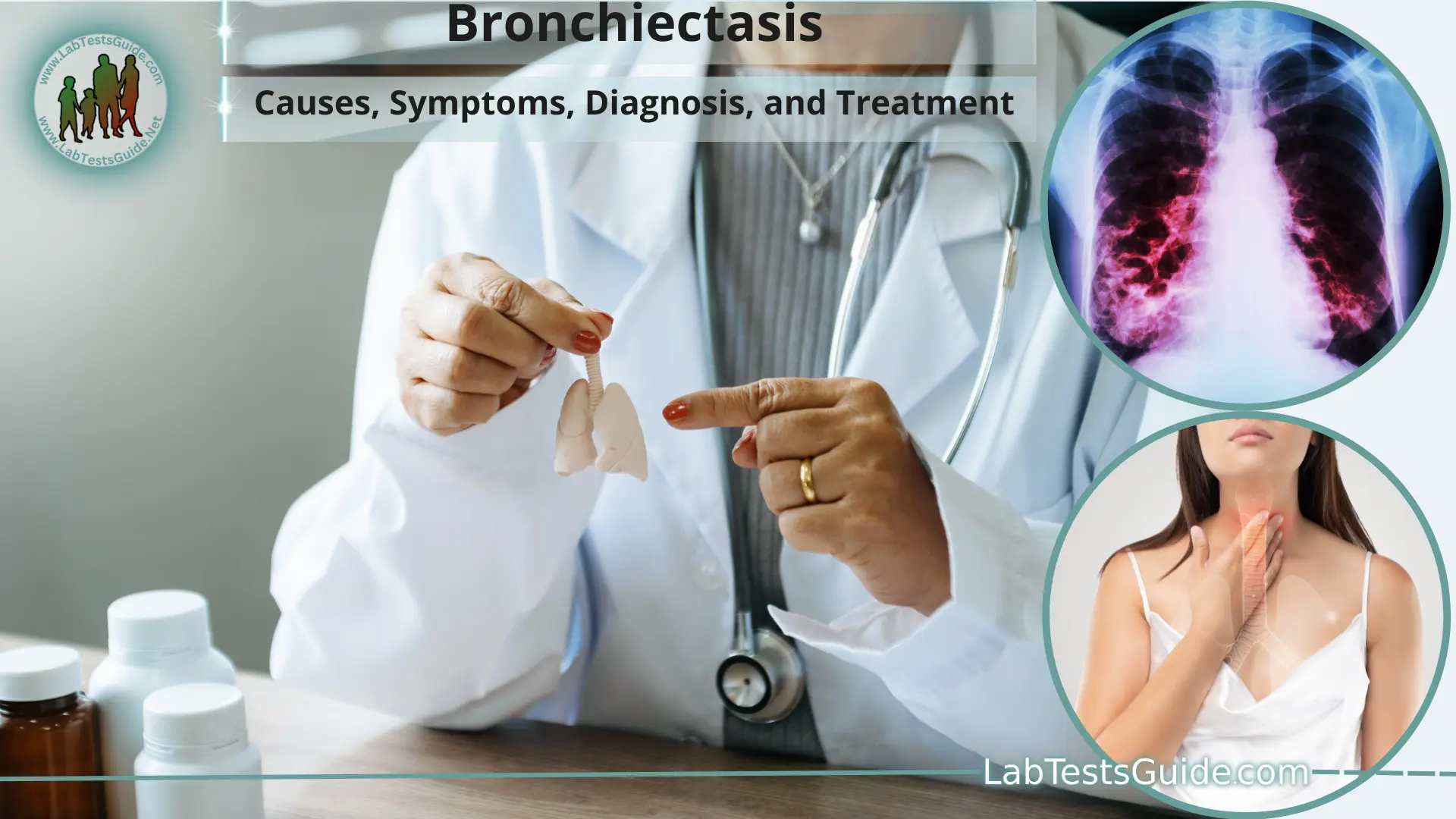 Bronchiectasis: Causes, Symptoms, Diagnosis, And Treatment