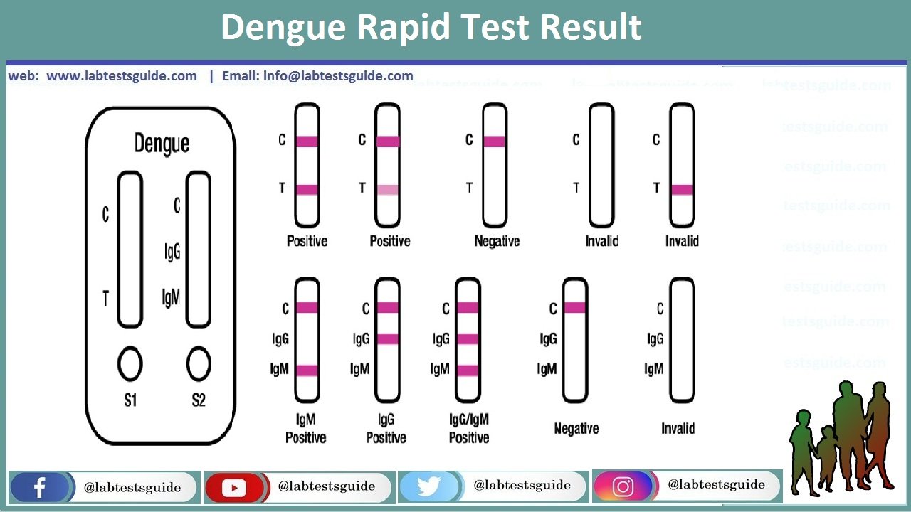 Dengue Igg Igm Rapid Diagnostic Test Principle Results And More Lab Tests Guide