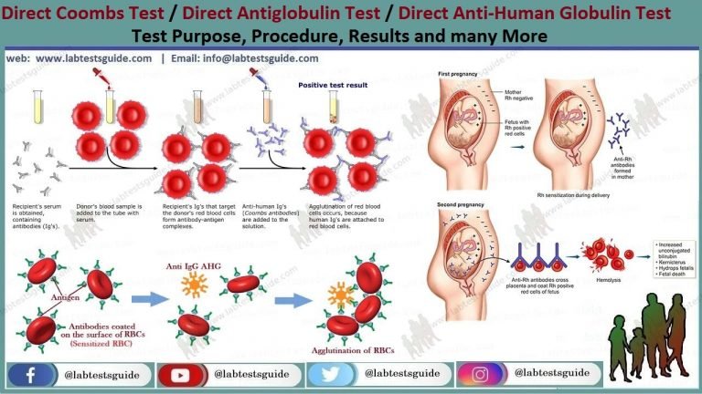 direct-coombs-test-purpose-result-and-more-lab-tests-guide