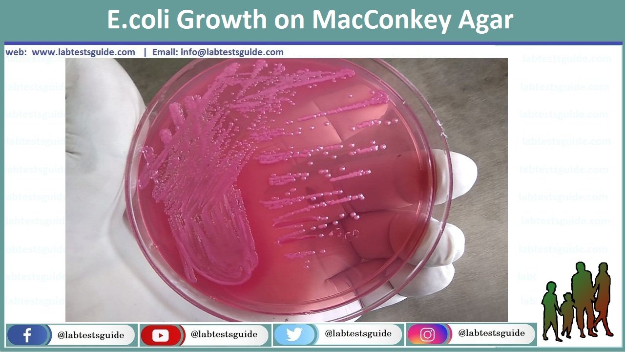 E Coli Diagnosis Procedure And Interpretation Lab Tests Guide 4677