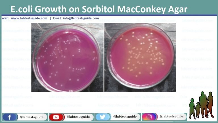 E Coli Diagnosis Procedure And Interpretation Lab