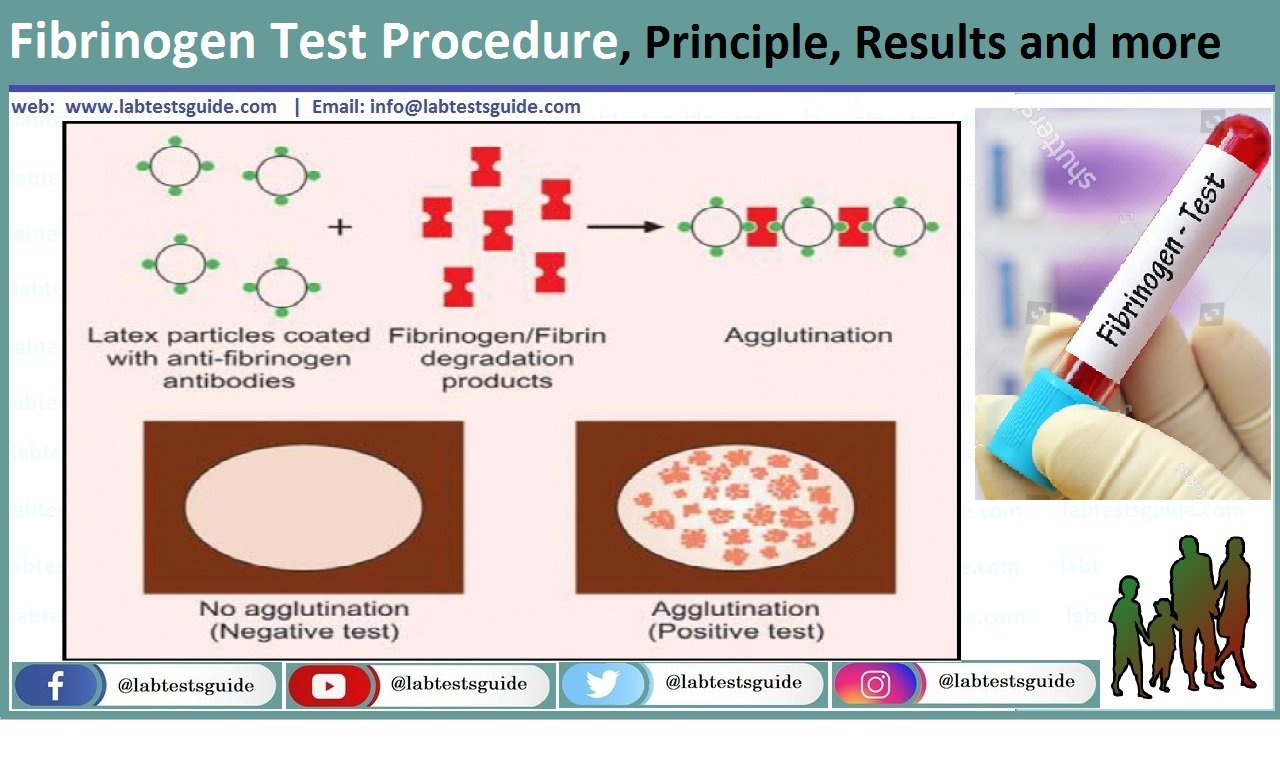 fibrinogen-test-procedure-principle-results-and-more-lab-tests-guide