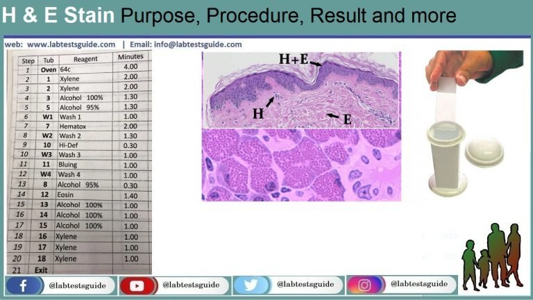 Hematoxylin And Eosin Staining Protocol Principle Pro 