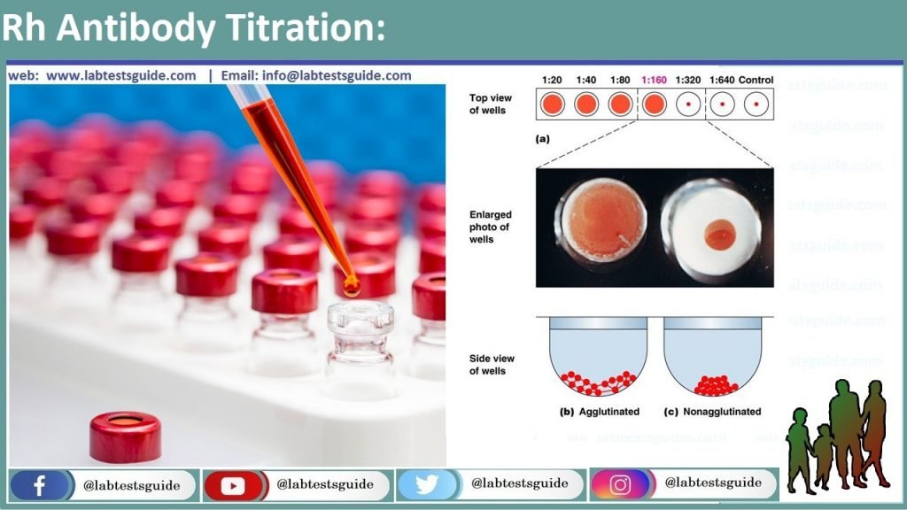 Antibody Titer Explanation Lab Tests Guide 4769