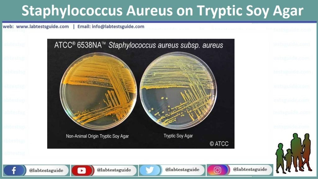 staphylococcus-aureus-infections-culture-and-more-lab-tests-guide