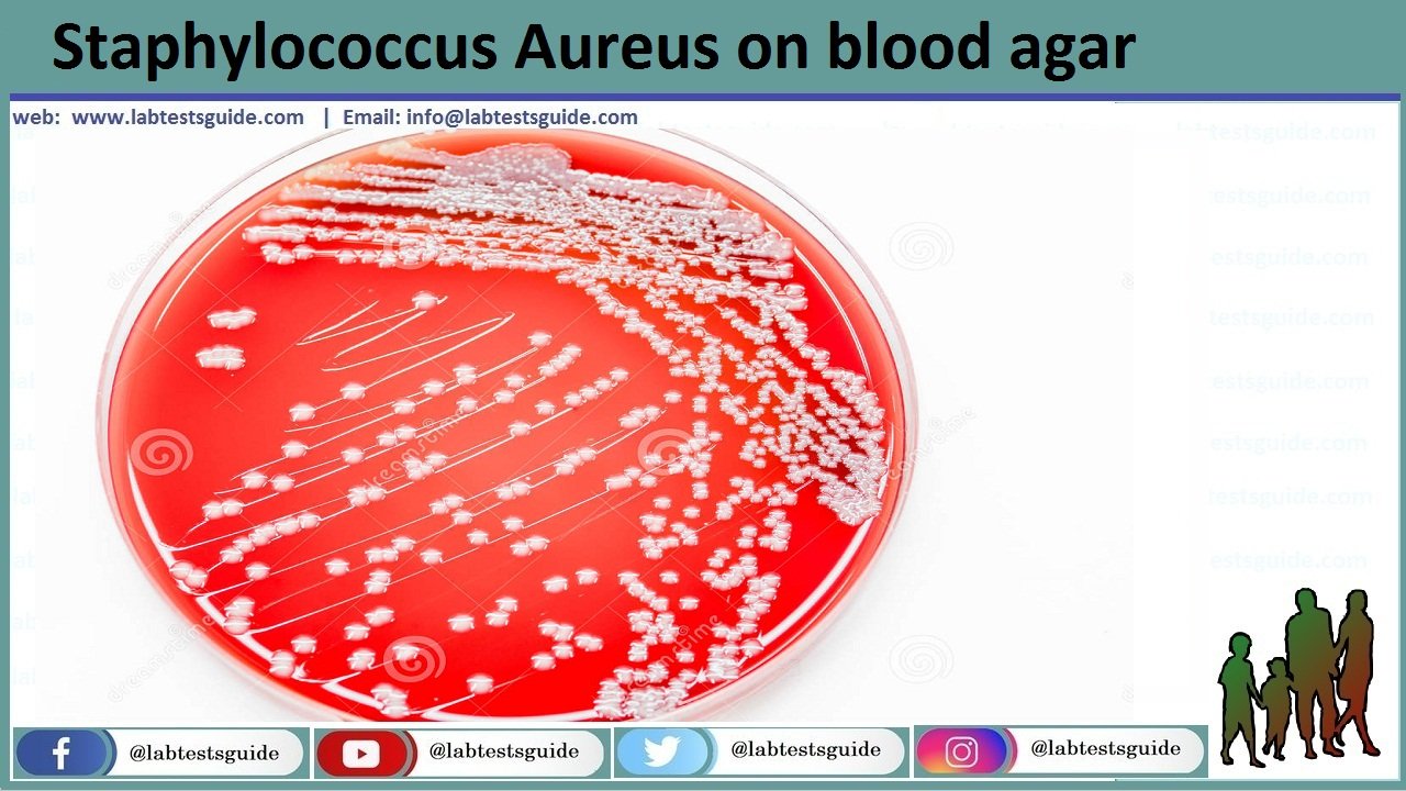 Staphylococcus Aureus Culture Media