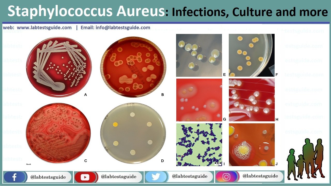 Staphylococcus Aureus Characteristics Biochemical Tests And Others 