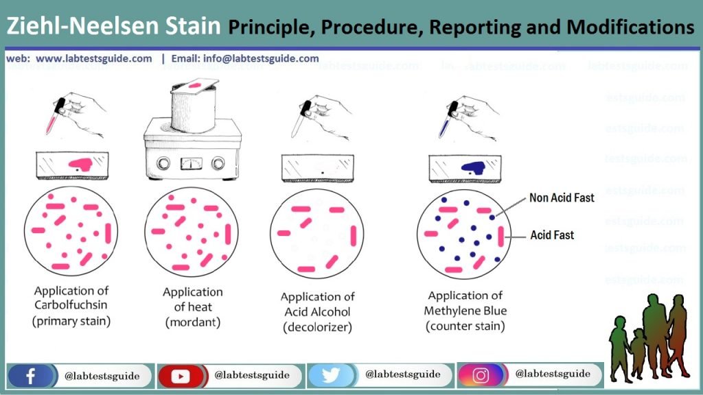 Z. N Staining Uses, Procedure, Results And More | Lab Tests Guide