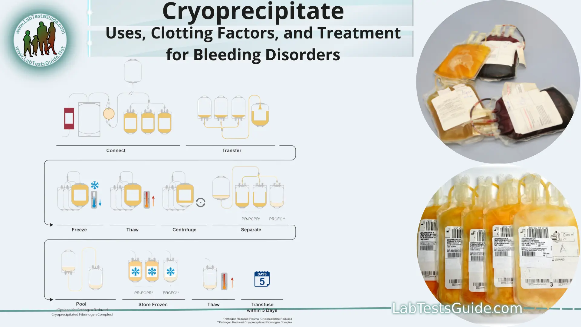 Blood bag plasma hi-res stock photography and images - Page 4 - Alamy