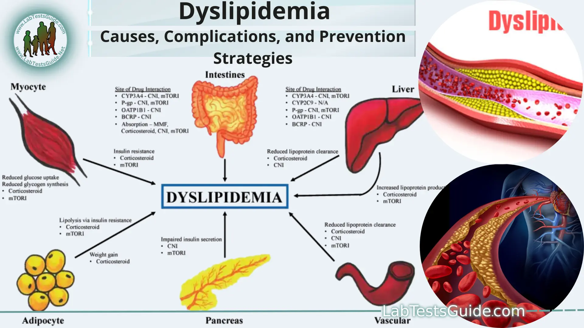 Understanding Dyslipidemia Causes Complications And Prevention Strategies 5506