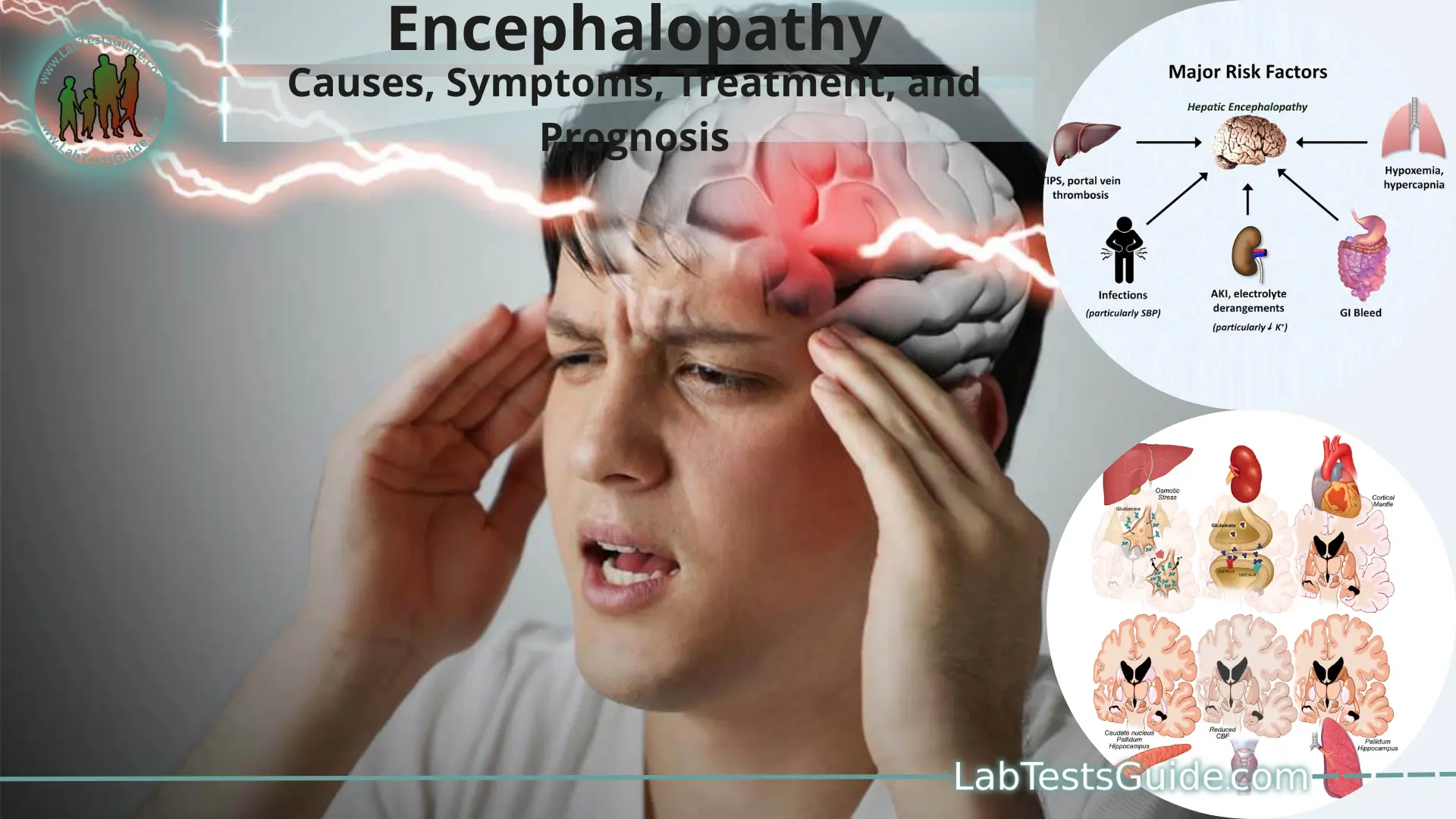 Encephalopathy | Lab Tests Guide