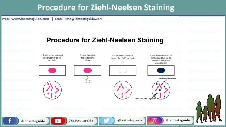 Z N Staining Uses Procedure Results And More Lab Tests Guide