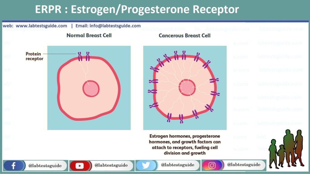 ERPR : Estrogen/Progesterone Receptor | Lab Tests Guide