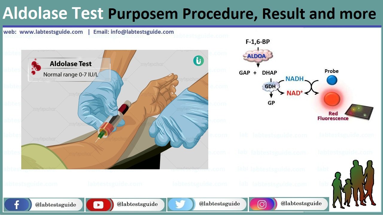 Aldolase Test Purpose Procedure Result And More Lab Tests Guide