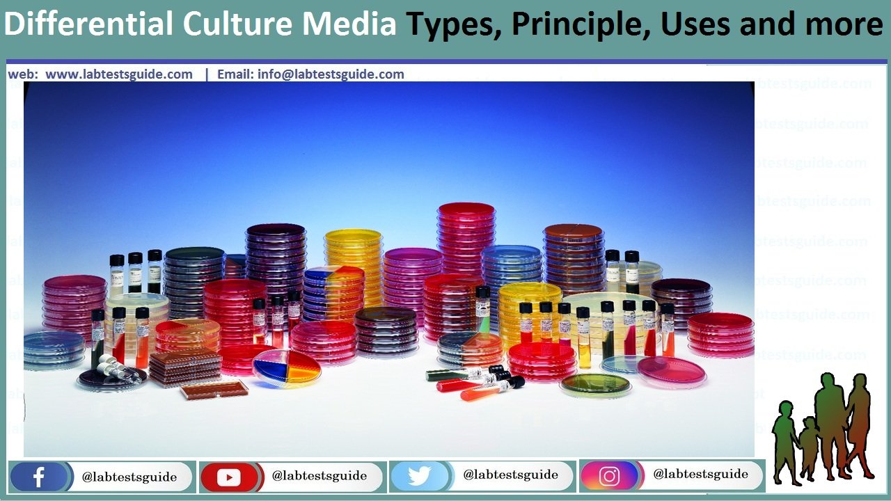 Differential Culture Media Types, Principle, Uses and more | Lab Tests