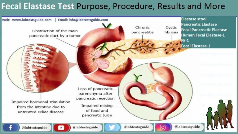 Pancreatic Elastase Test Purpose Procedure Results And More Lab 