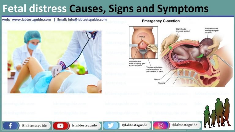 fetal-distress-causes-symptoms-and-signs-lab-tests-guide