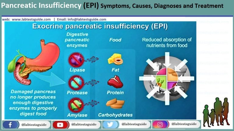 Pancreatic Insufficiency (EPI) Symptoms, Causes, Diagnoses And ...