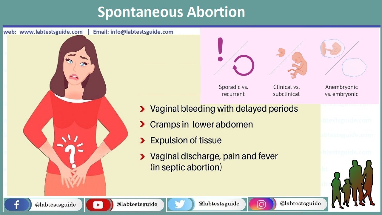 spontaneous-abortion-lab-tests-guide