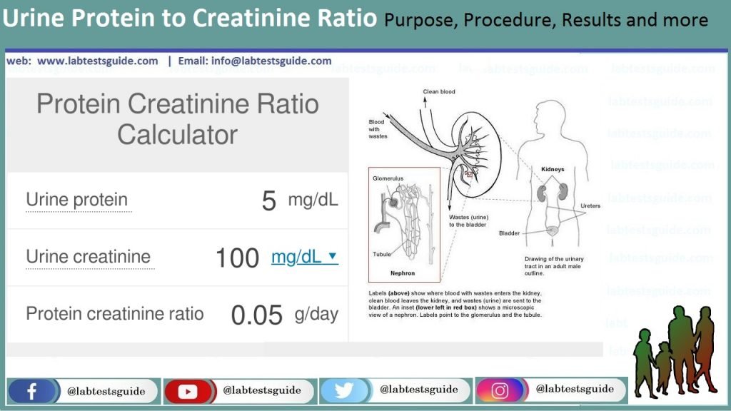 Urine Protein To Creatinine Ratio Purpose Procedure Results And More Lab Tests Guide 0038