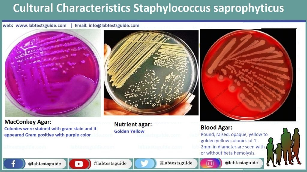 Urine Culture Interpretation, Identification and more | Lab Tests Guide