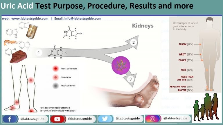 case study of uric acid