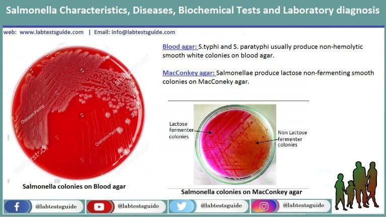 Salmonella | Lab Tests Guide