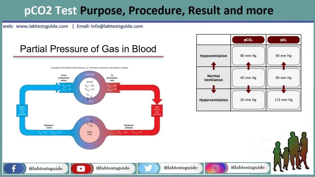 pco2-test-purpose-procedure-result-and-more-lab-tests-guide