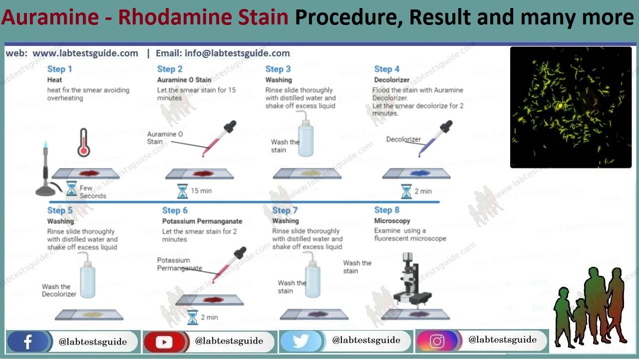 Auramine Stain Procedure, Result Interpretation and more | LTG