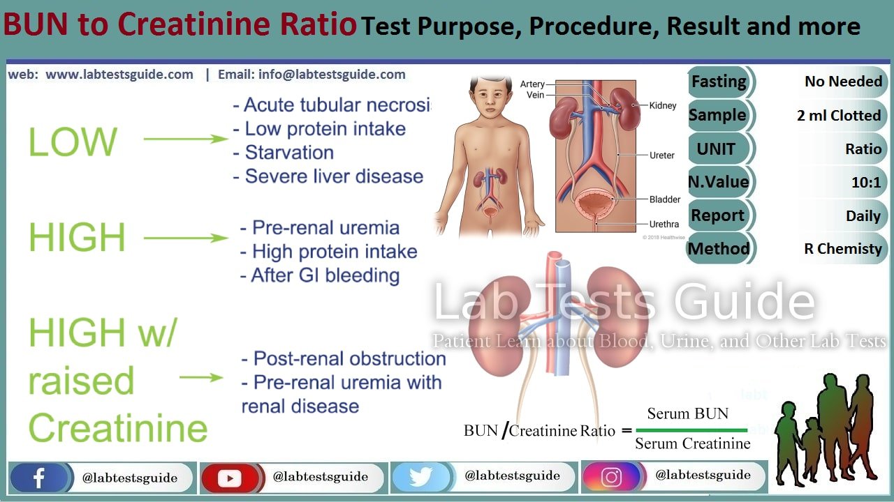 BUN Creatinine Ratio Test Purpose Procedure Results And More Lab 