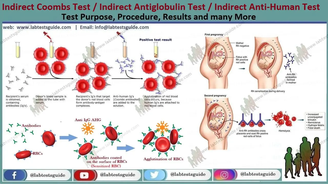 indirect-antiglobulin-test-iat-a-comprehensive-guide