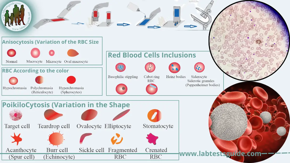 The criteria of a good blood film