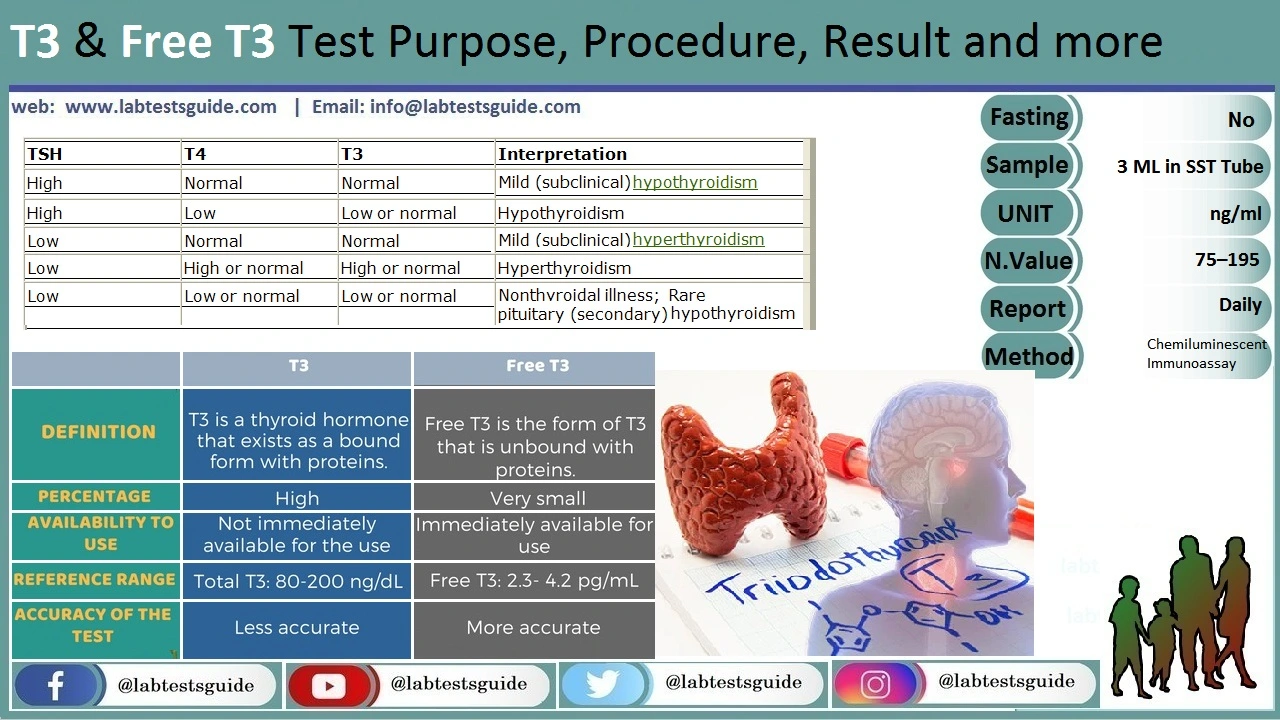 T Radioimmunoassay Test Purpose Procedure Result And More