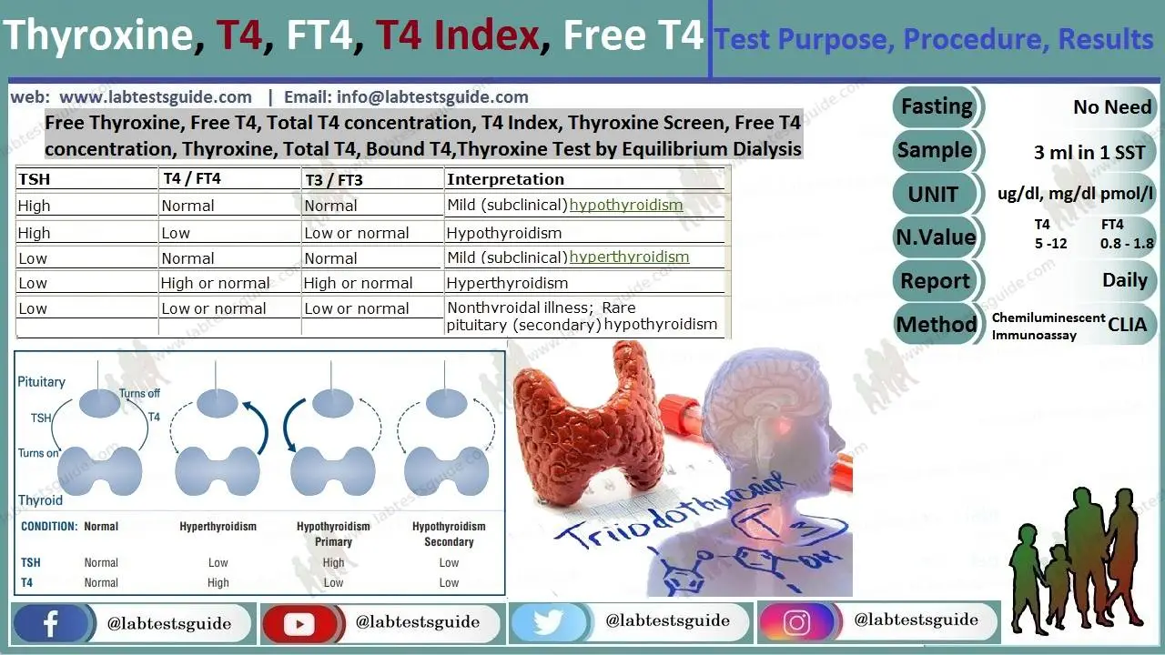 t4-test-purpose-procedure-result-interpretation-and-more