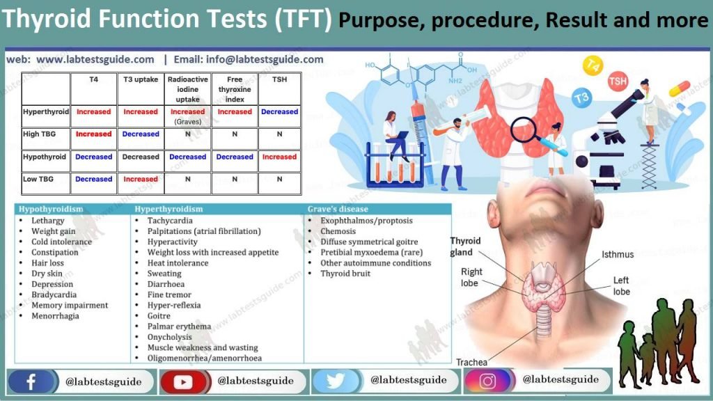 tft-lab-tests-guide