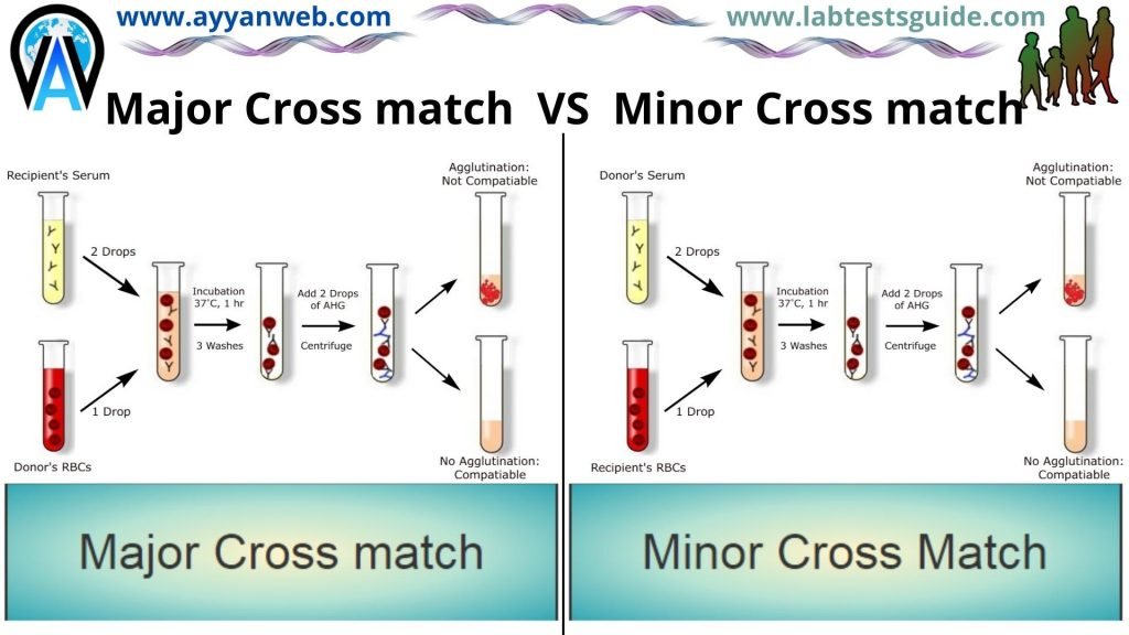 What is the difference between the major and minor crossmatch? | Lab ...