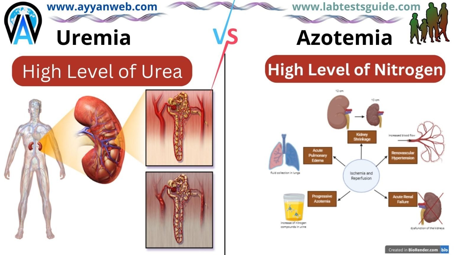 Urea Lab Tests Guide