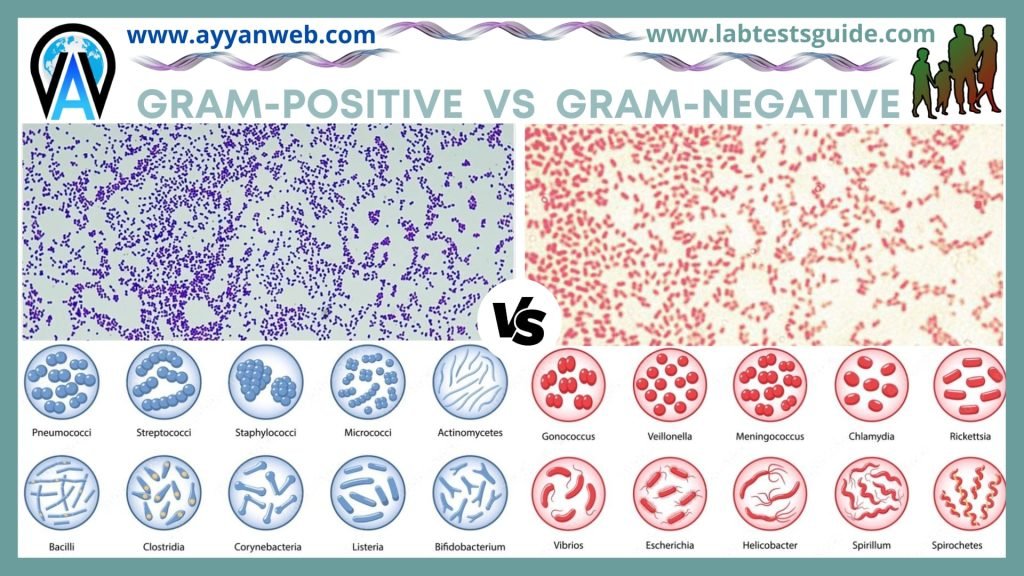 gram positive vs gram negative shape