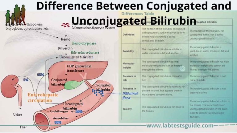 Conjugated Bilirubin VS Unconjugated Bilirubin | Lab Tests Guide