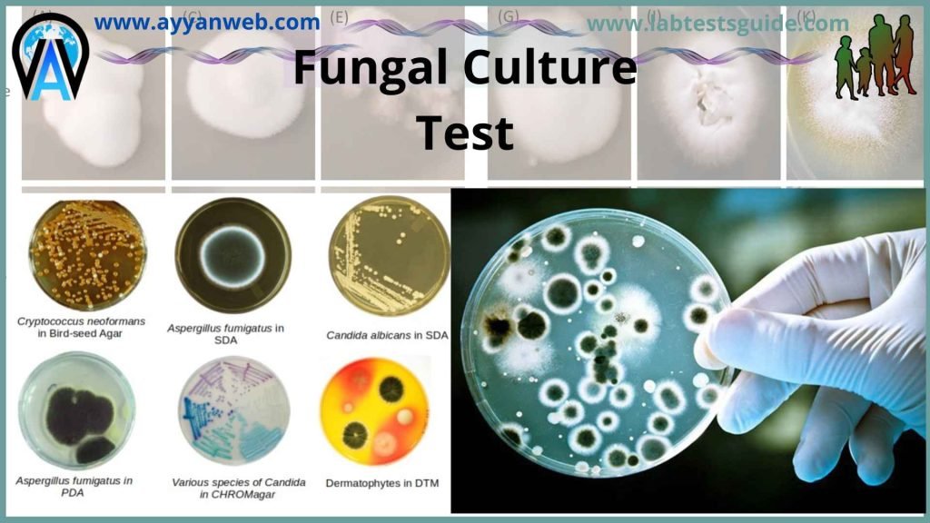 TB Culture Purpose, Types, Procedure, And More | Lab Tests Guide