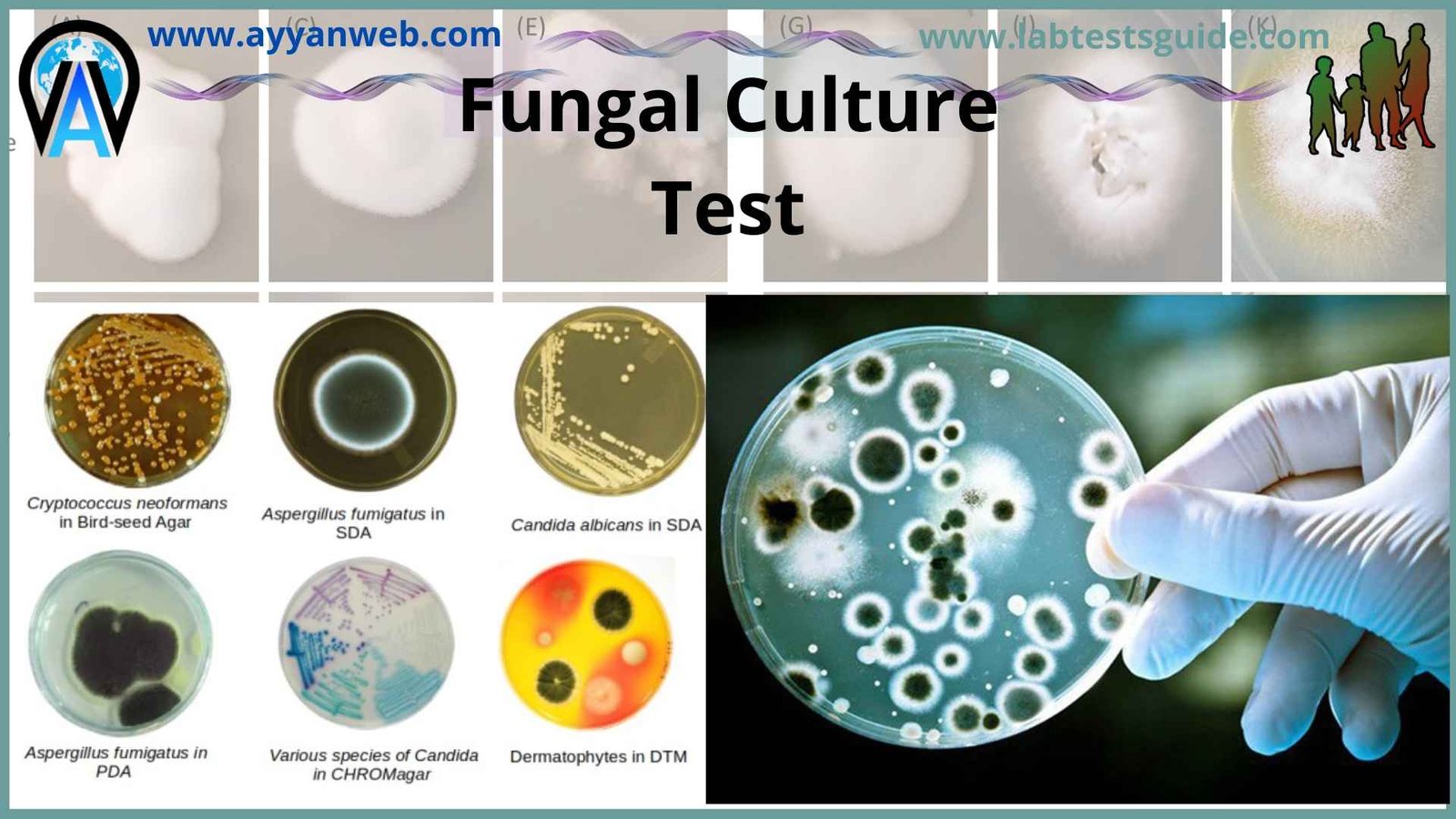 Fungal Culture Purpose Procedure Results And More Ltg