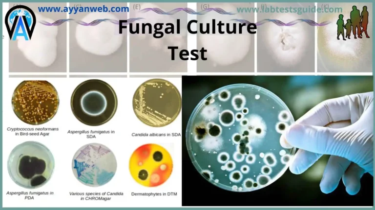 Fungal Culture