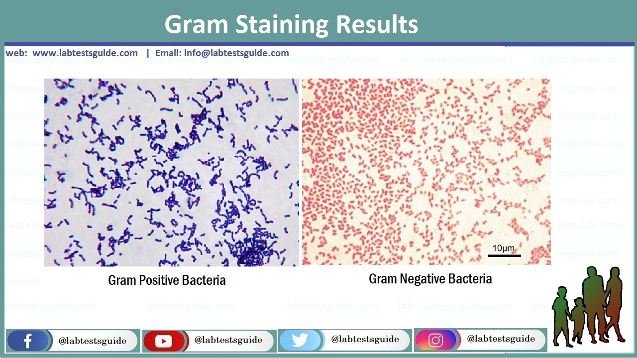 Microscopic Identification of Gram Positive and Gram Negative Bacteria