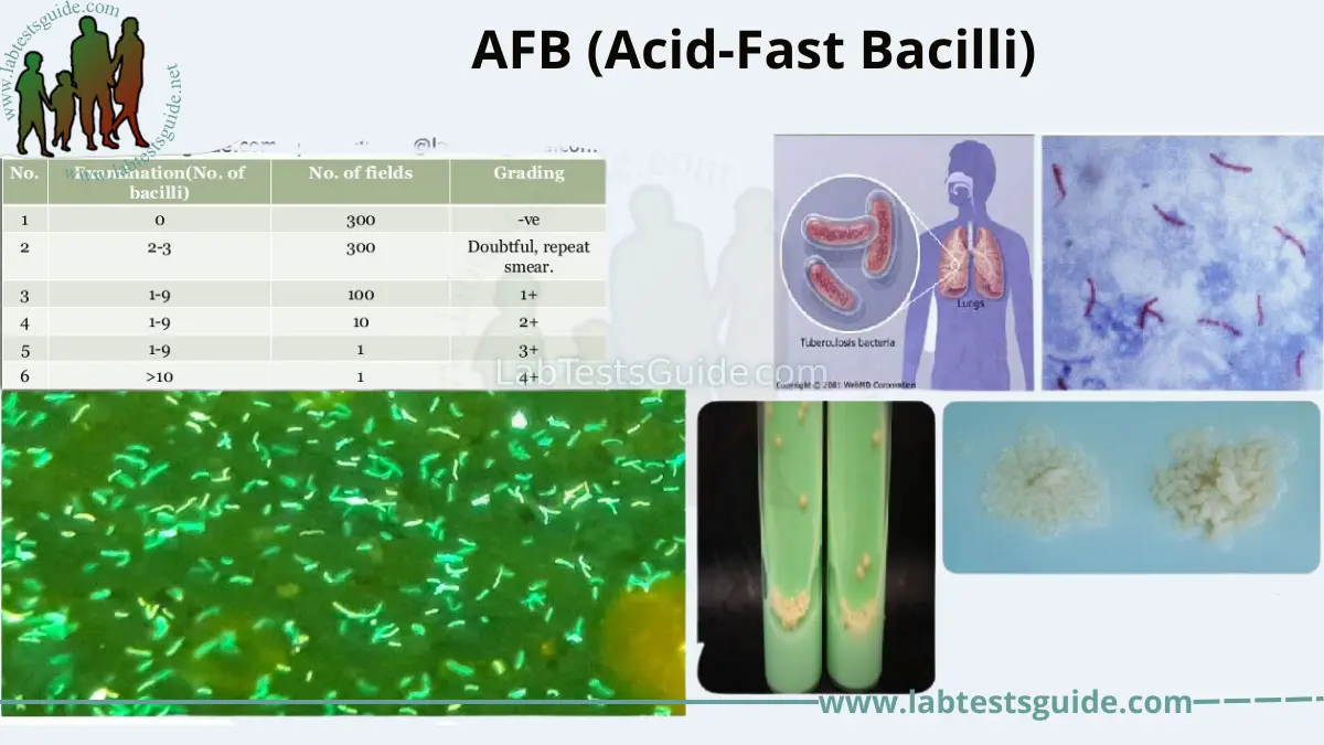 AFB (Acid-Fast Bacilli) | Lab Tests Guide